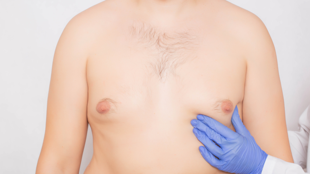 18 Male Breast Reduction