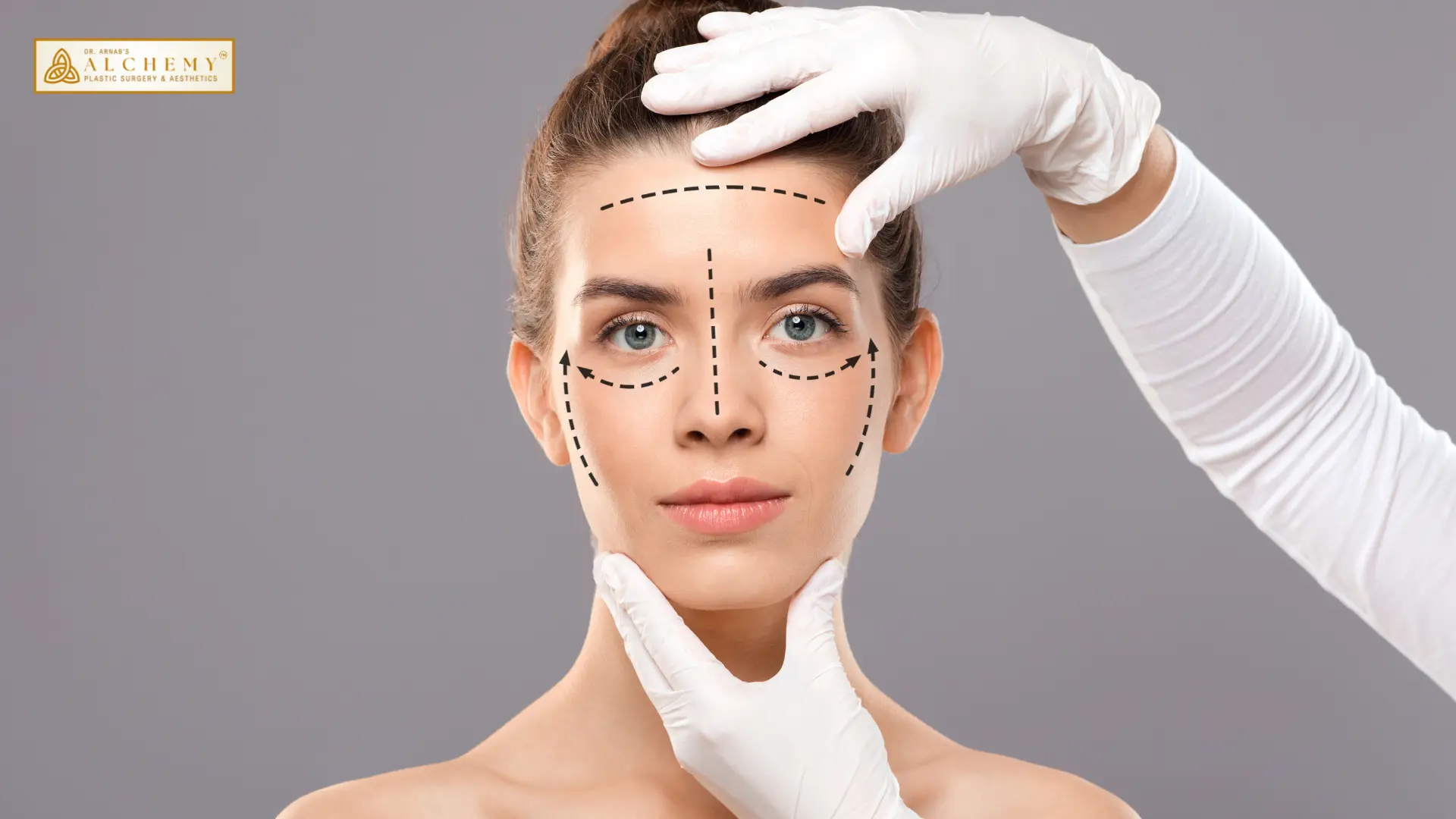 Face Lift Surgery In Vadodara