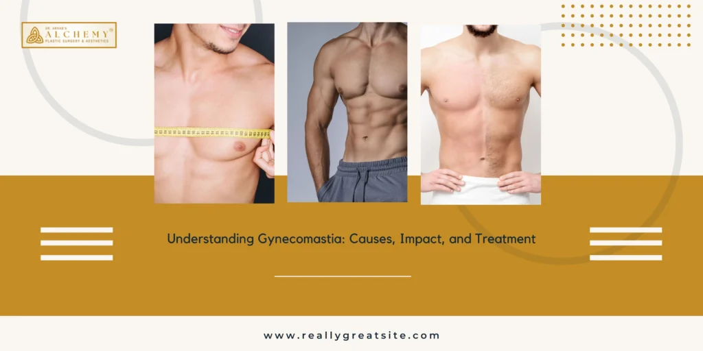 Gynecomastia Treatment In Vadodara