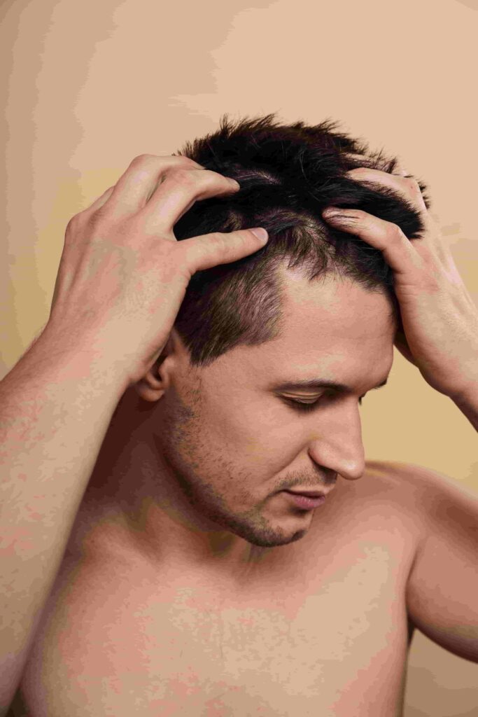 Hair Transplant in vadodara min Home